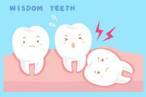 Wisdom tooth removal common causes