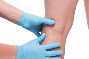 leg pain treatments doctor esamining